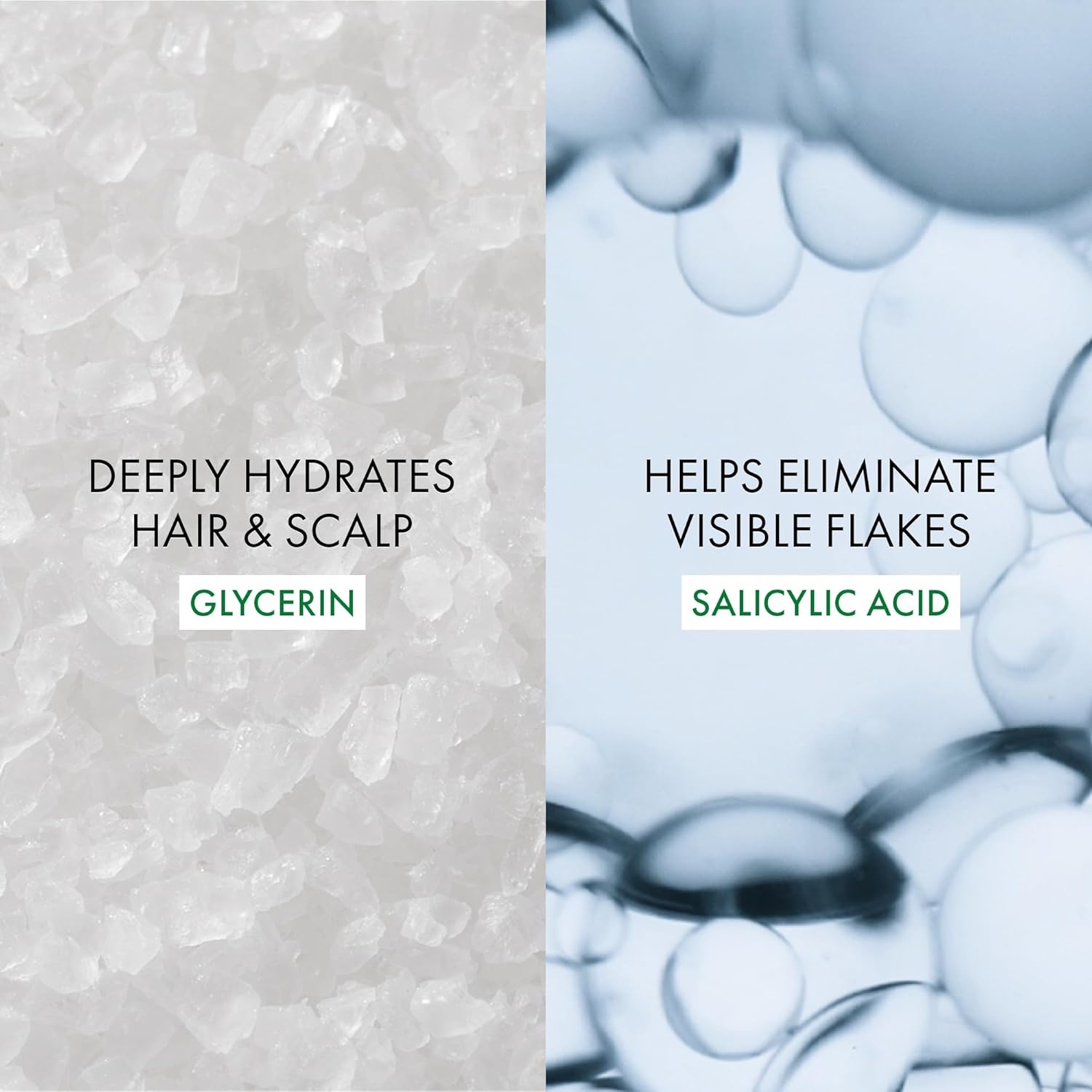 image:imageVICHY Dercos Salicylic Acid Anti Dandruff Shampoo 200 ml Water to Foam Dandruff Shampoo and Itchy Scalp Treatment Provides Definition amp Frizz Control for Curly Hair Types Sulfate Free