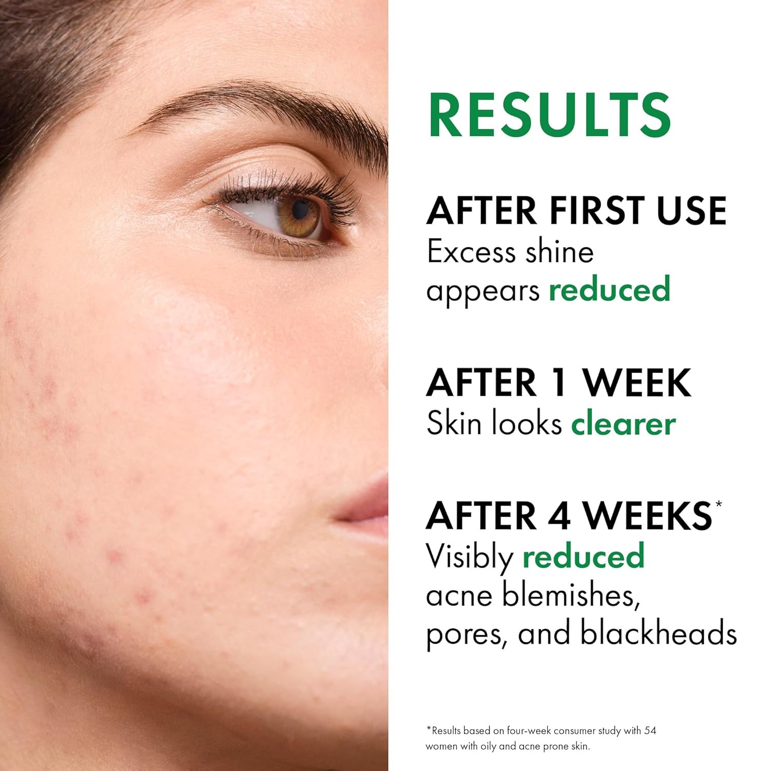 image:imageVICHY Normaderm Daily Acne Face Wash Salicylic Acid Face Cleanser for Oily amp Acne Prone Skin Acne Cleanser that Clears Clogged Pores and Blackhead1352 Fl Oz Pack of 2