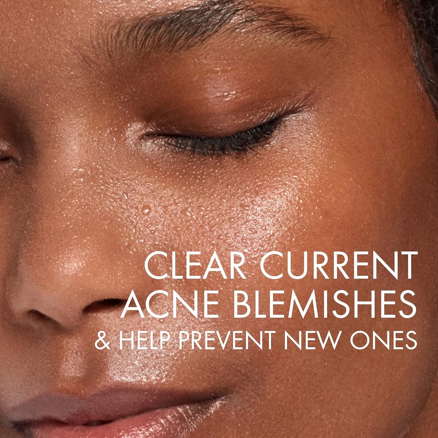 image:imageVICHY Normaderm Daily Acne Face Wash Salicylic Acid Face Cleanser for Oily amp Acne Prone Skin Acne Cleanser that Clears Clogged Pores and Blackhead676 Fl Oz Pack of 1