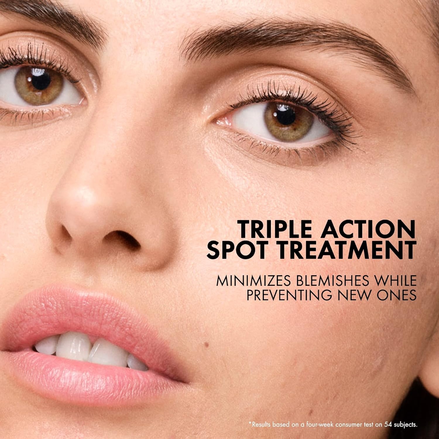 image:imageVichy Normaderm SOS Acne Rescue Spot Corrector Acne Spot Treatment for Face with 10 Sulfur Niacinamide amp Glycolic Acid Suitable for Sensitive Skin